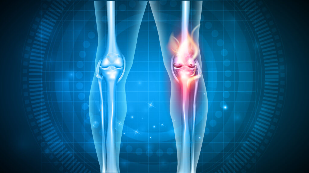Joint problems bright abstract design, burning damaged knee