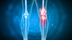 Knee pain treatment